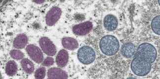 Understanding MPOX: WHO Declares Global Health Emergency – Liverpool Echo news-15082024-143119