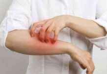 Rising Scabies Cases at Warrington Hospital: What You Need to Know news-10102024-104711