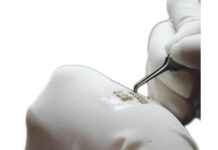 Essential Post-Operative Tips for a Successful Hair Transplant Recovery Essential Post-Operative Tips for a Successful Hair Transplant Recovery