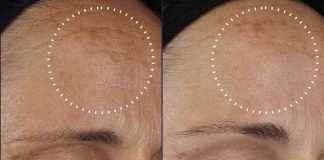 25% Off Black Friday Sale at Medik8 news-01122024-112459